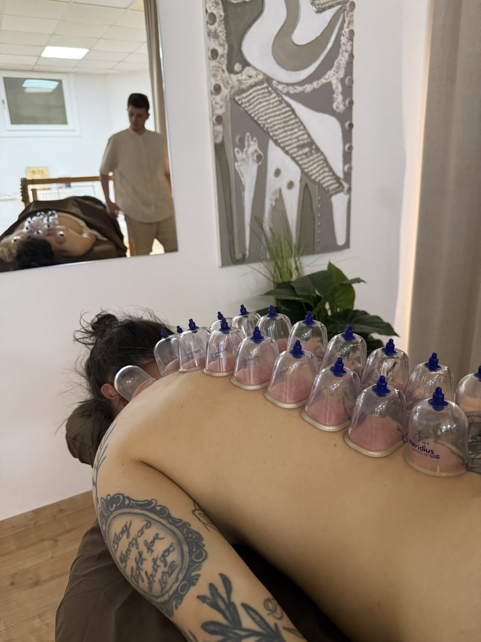 Cupping & Gua Sha